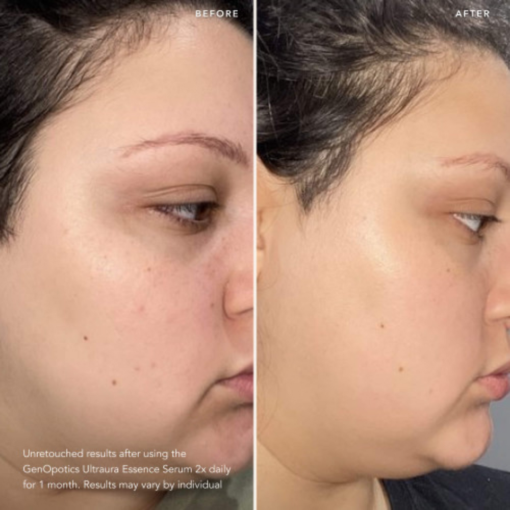 GenOptics Ultraura Essence Serum