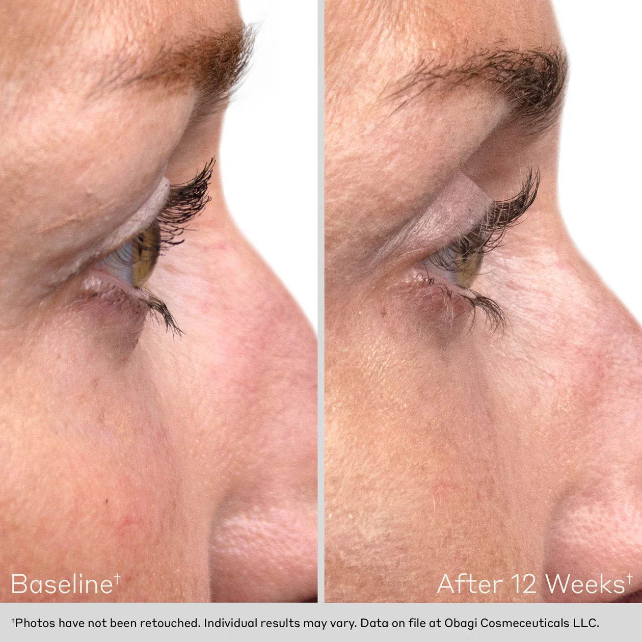 Nu Cil Eyelash Enhancing Serum