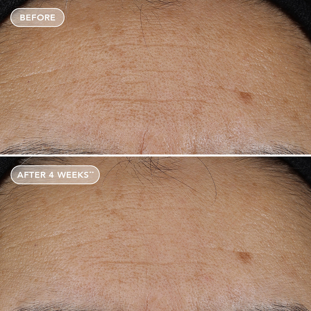 AGELESS+ retinol repair crème 0.3% retinol complex Model Image