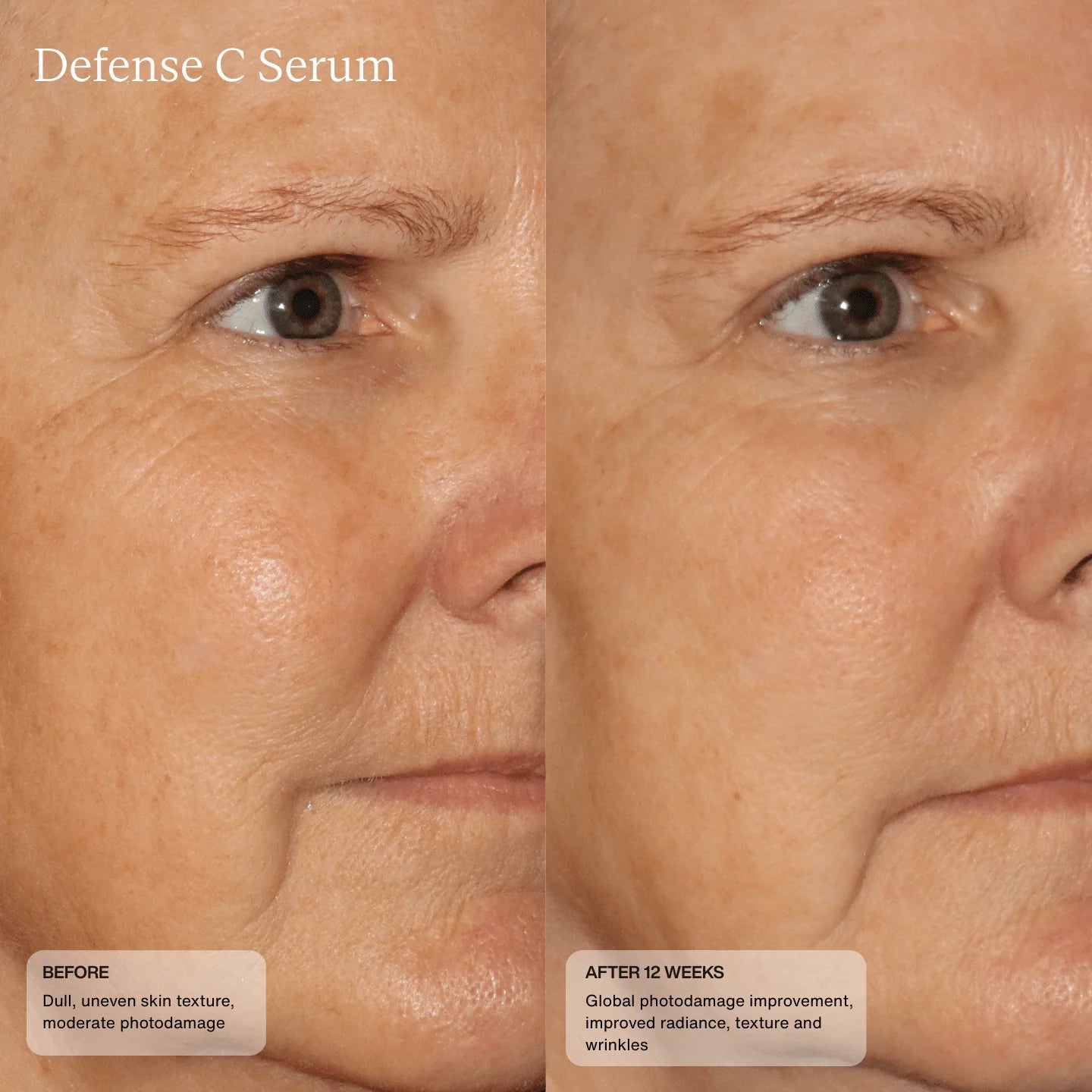 Defense C Serum Model Image 1