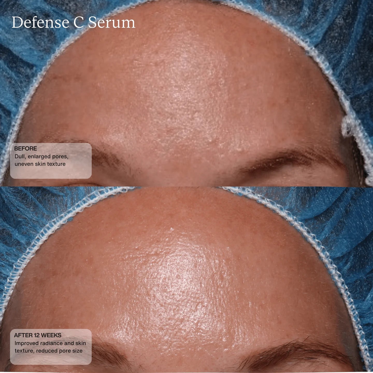 Defense C Serum Model Image 2