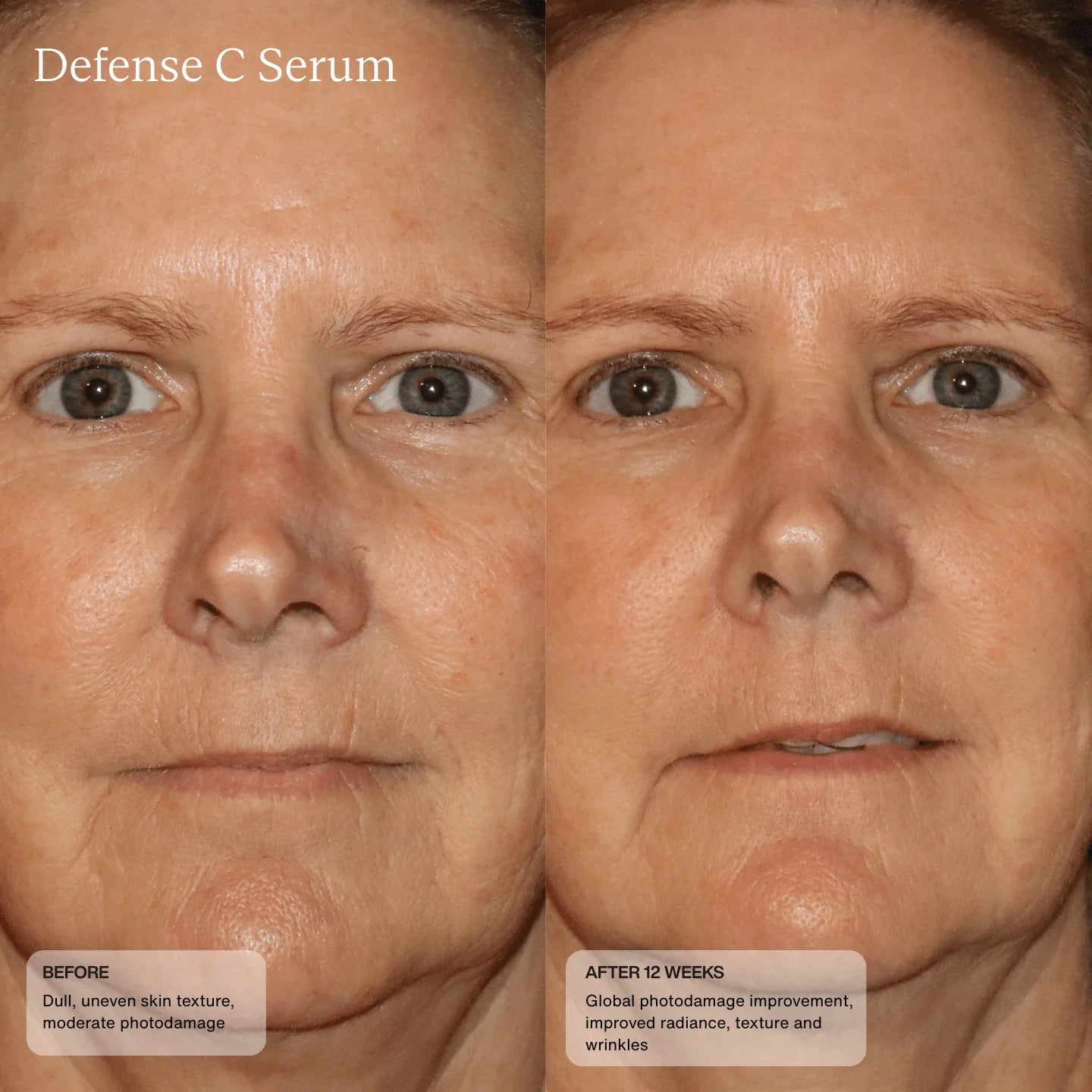 Defense C Serum Model Image 3
