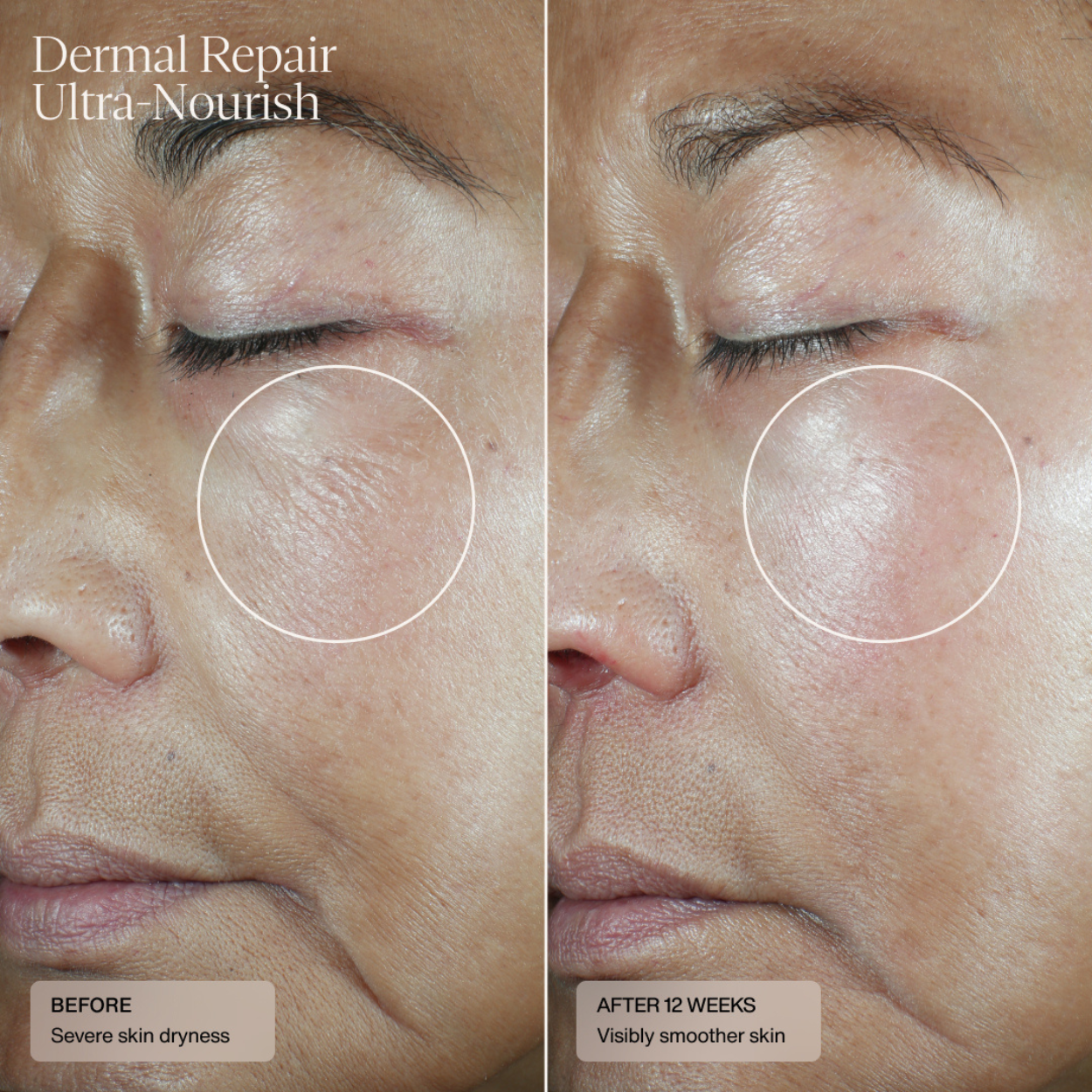 Dermal Repair Ultra Nourish