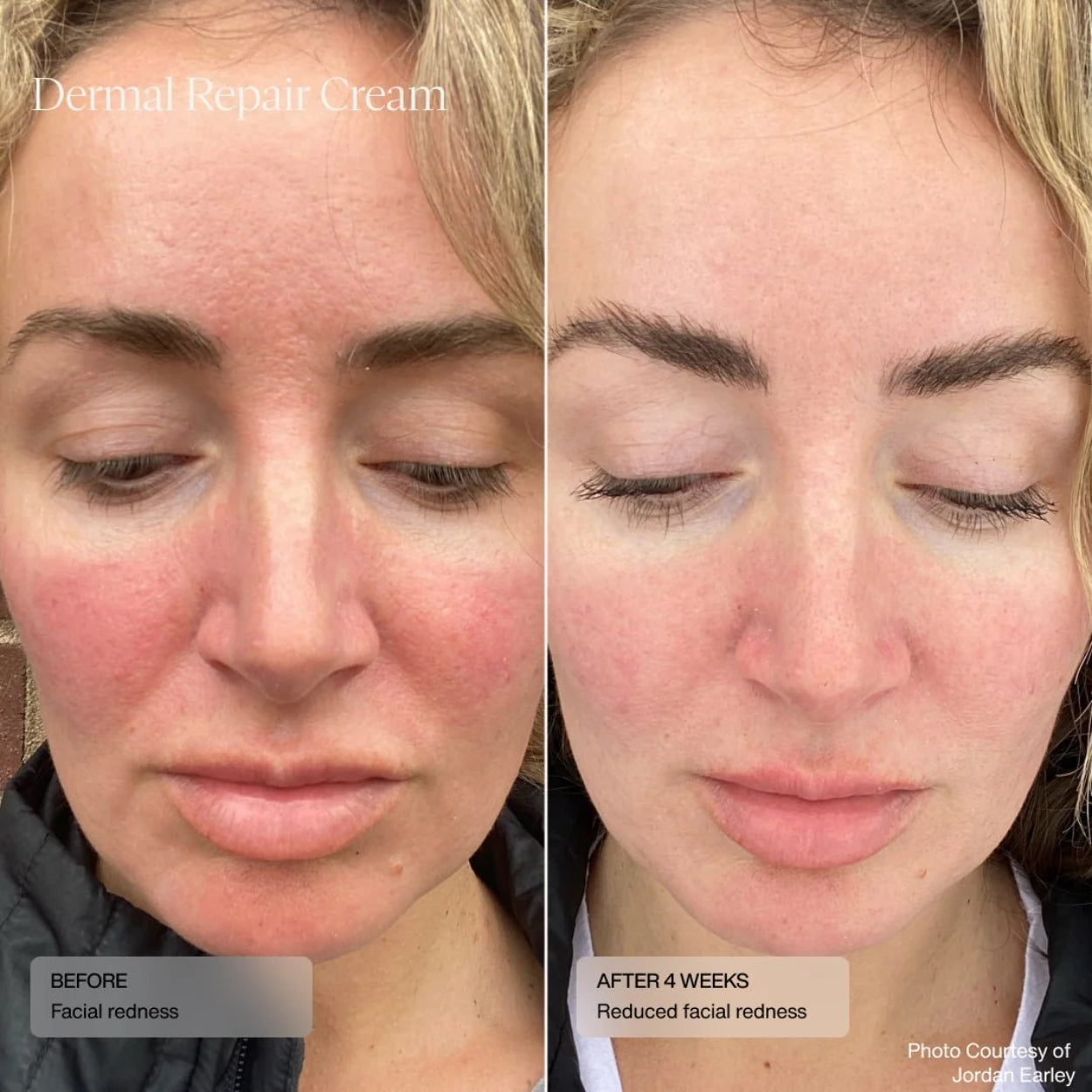 Dermal Repair Cream (CAD) Model Image  2