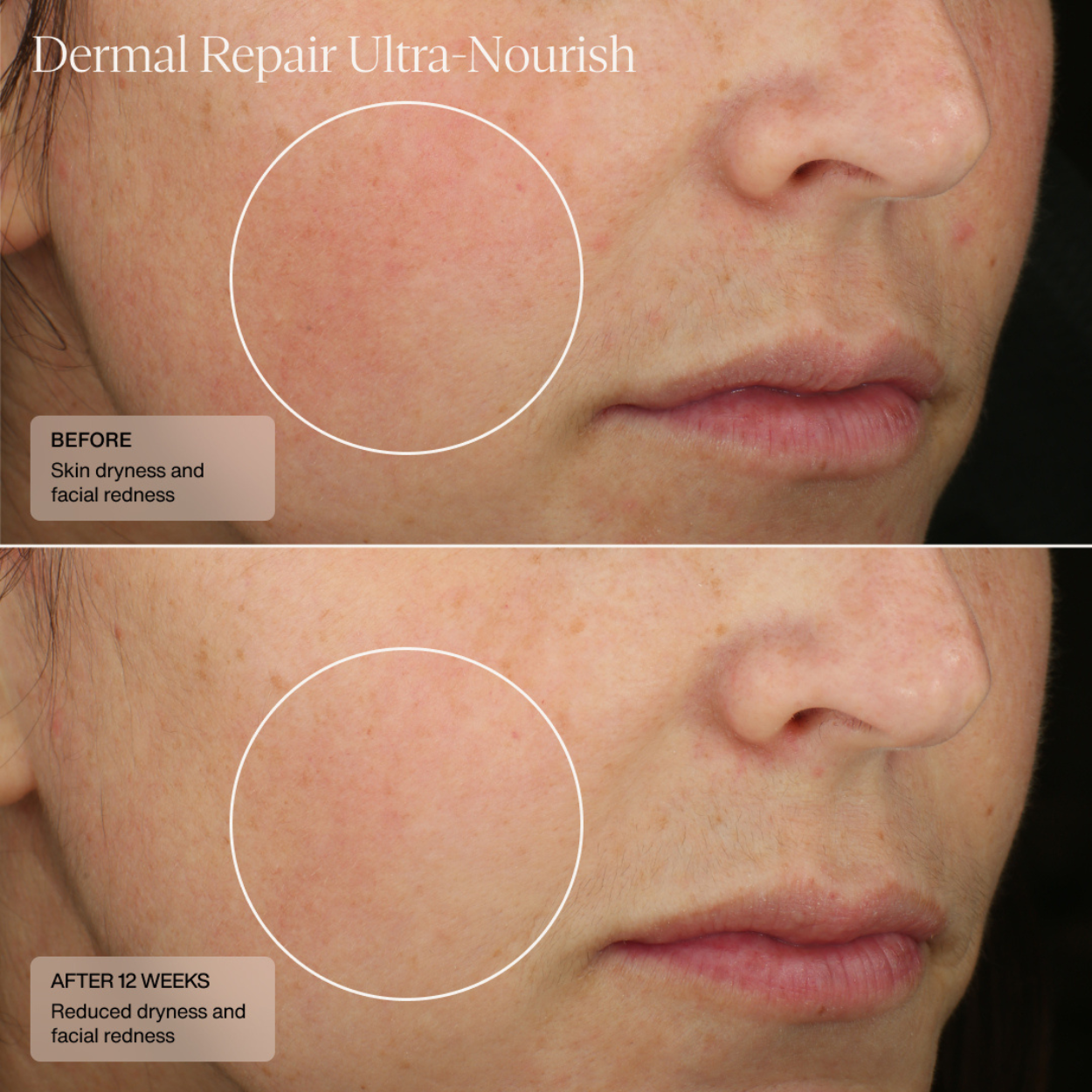 Dermal Repair Ultra Nourish 1.7 oz Model Image Canada 2