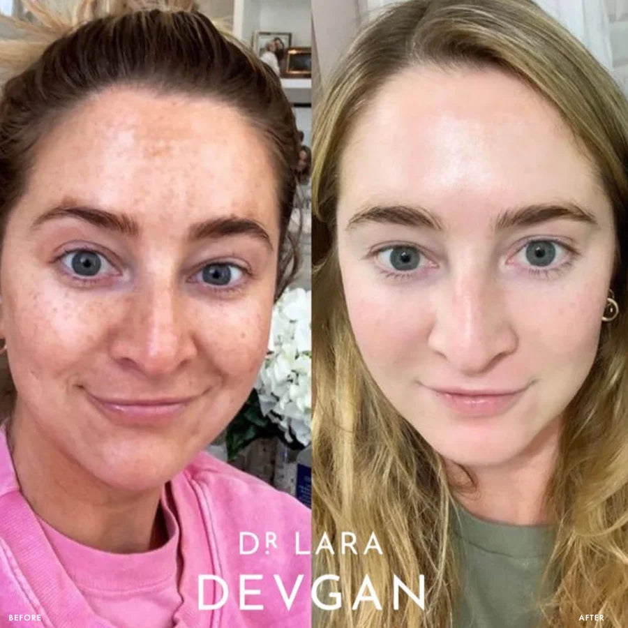 Vitamin C+B+E Ferulic Serum