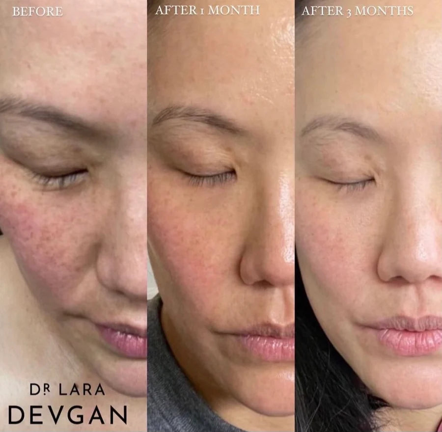 Vitamin C+B+E Ferulic Serum