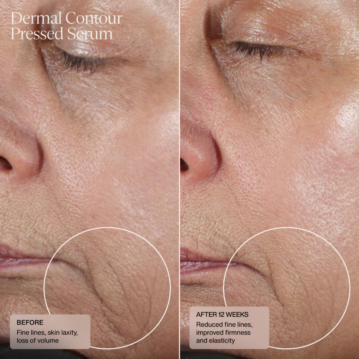 Hydrafirm (Dermal Contour Pressed Serum) (CAD) Clinical Result 1