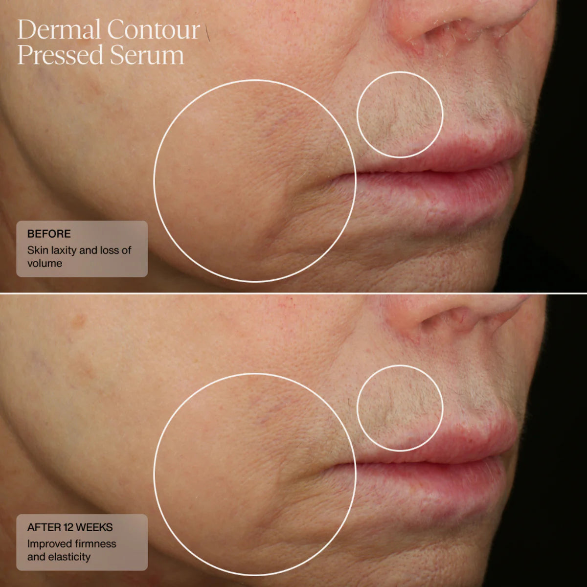 Hydrafirm (Dermal Contour Pressed Serum) (CAD) Clinical Results 