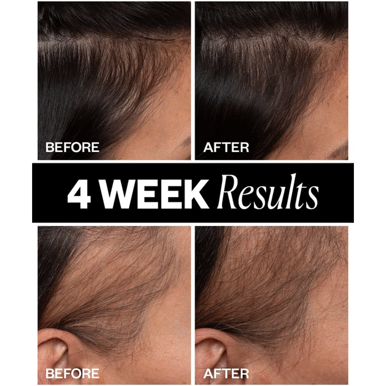SPONSORED Hair Density Scalp Treatment
