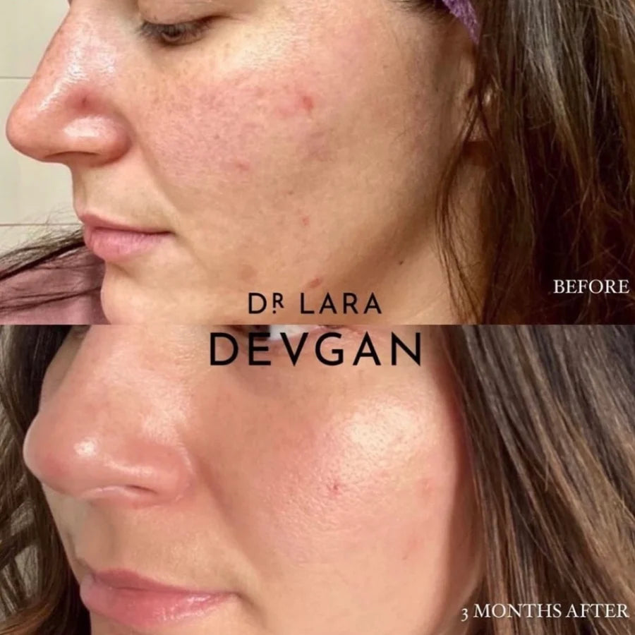 Vitamin C+B+E Ferulic Serum