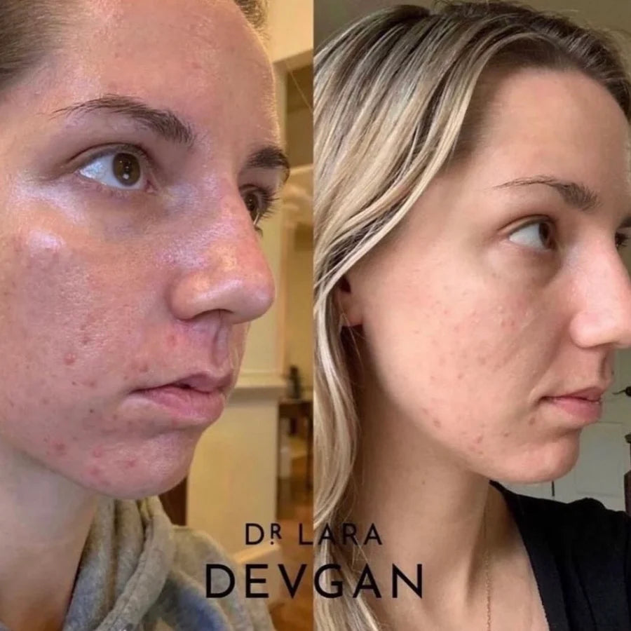 Vitamin C+B+E Ferulic Serum