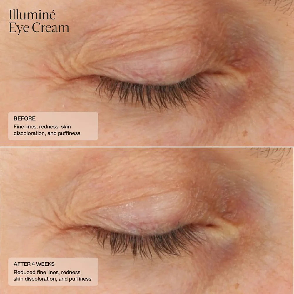 Illumine Eye Cream (CAD) Clinical Results