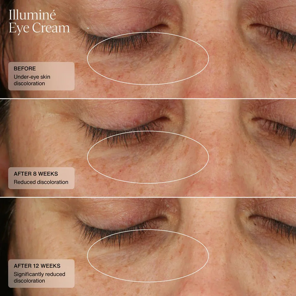 Illumine Eye Cream (CAD) Clinical Results 1