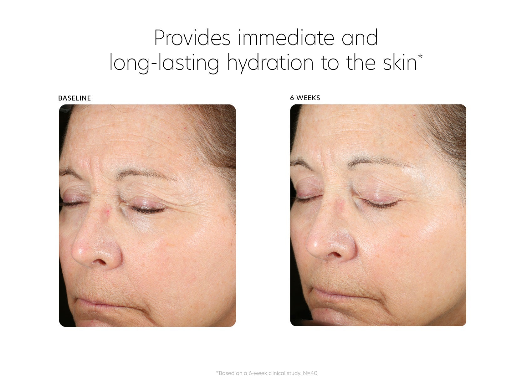 pca skin hyaluronic acid boosting serum clinical study