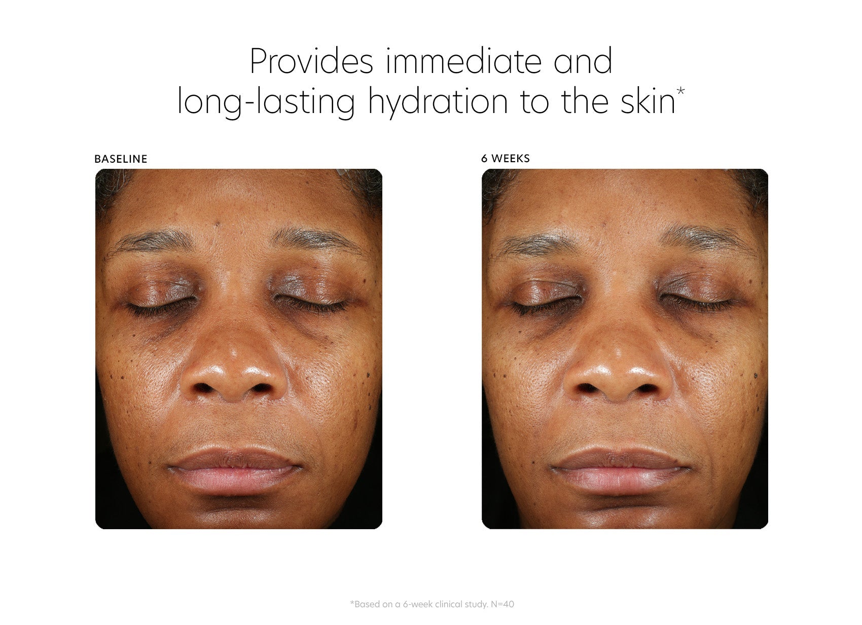 pca skin hyaluronic acid boosting serum clinical study