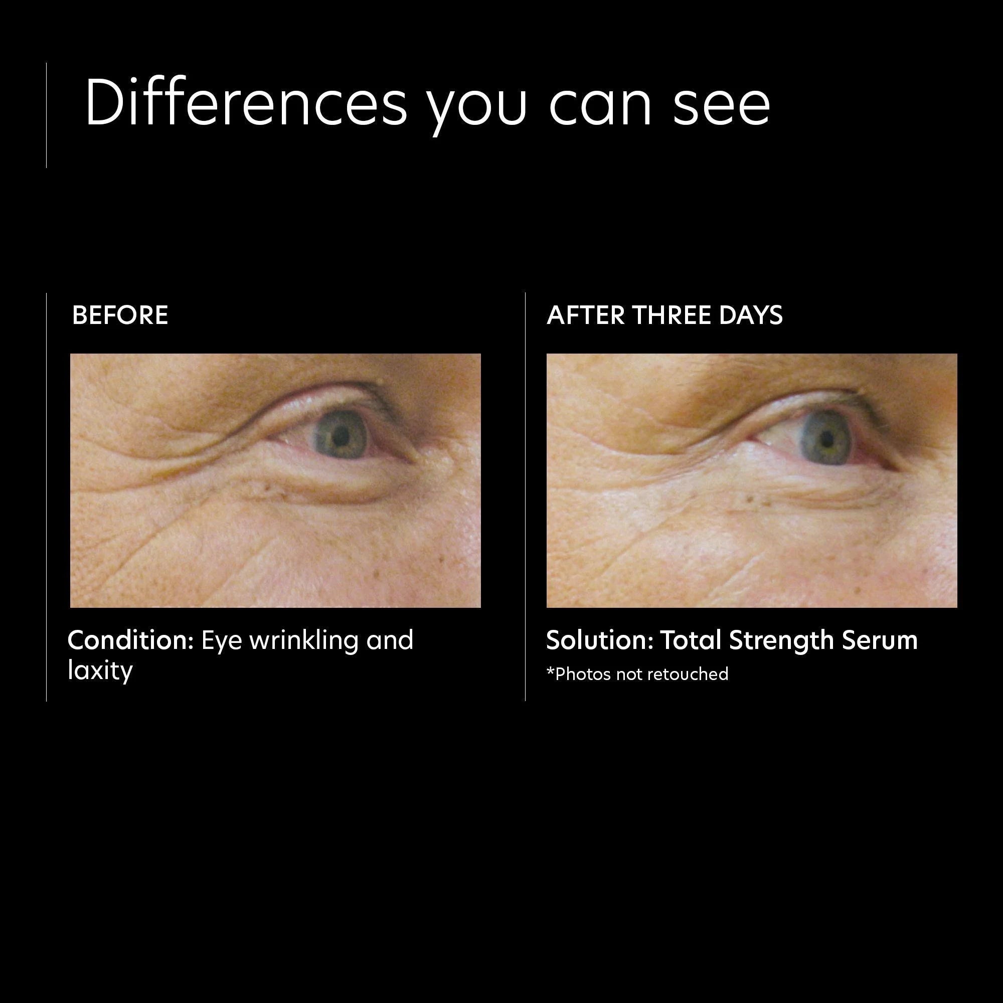 PCA_Skin_Total_Strength_Serum_Clinical_Study