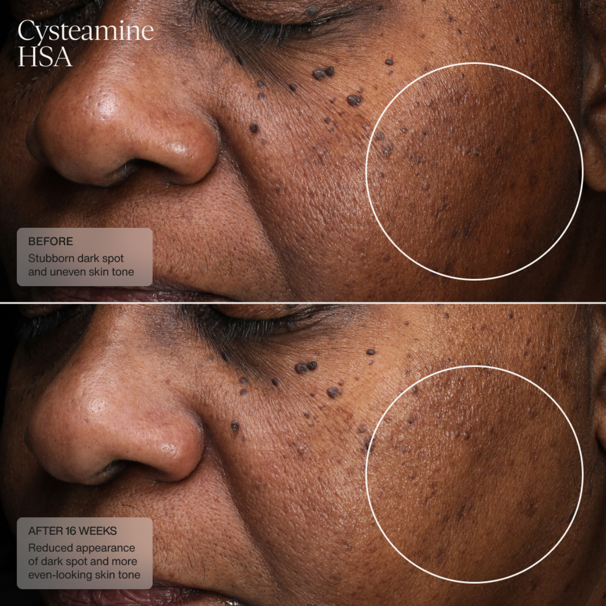 Pigment and Tone Correcting Mask (CAD) Clinical Results 1