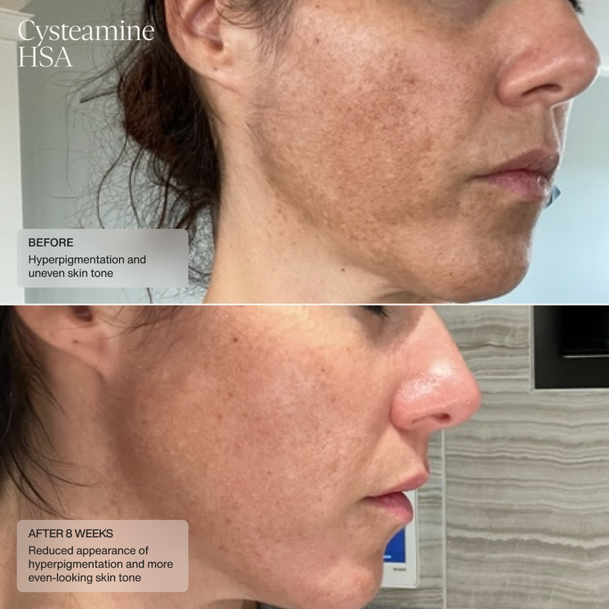 Pigment and Tone Correcting Mask (CAD) Clinical Results 2