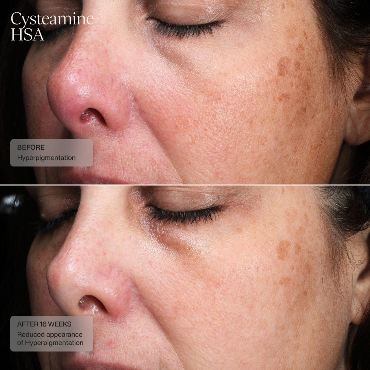 Pigment and Tone Correcting Mask (CAD) Clinical Results 3