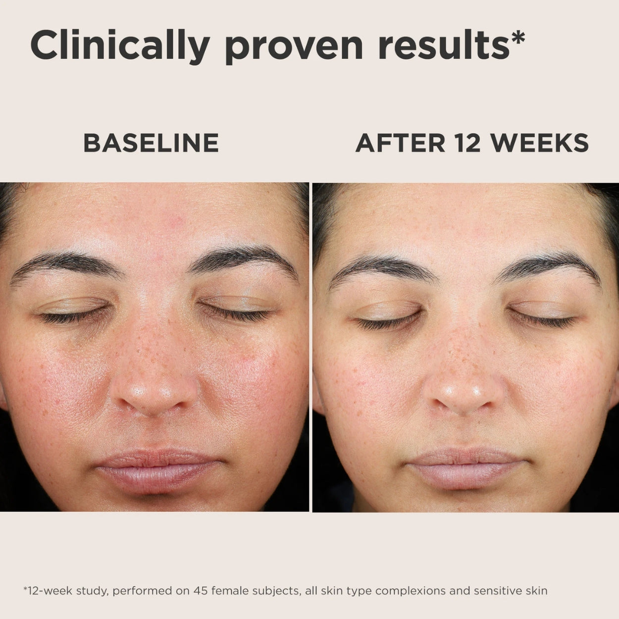 UV Skin Recovery Green Tint SPF 50 before after Image 1